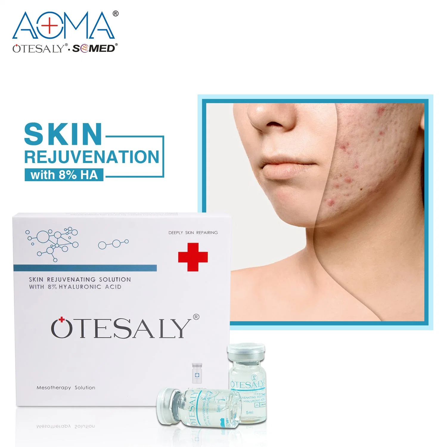 Otesaly High Quality Skin Rejuvernation with 8% Ha Fine Lines Skin Dry Mesotherapy Solution Via Meso Gun