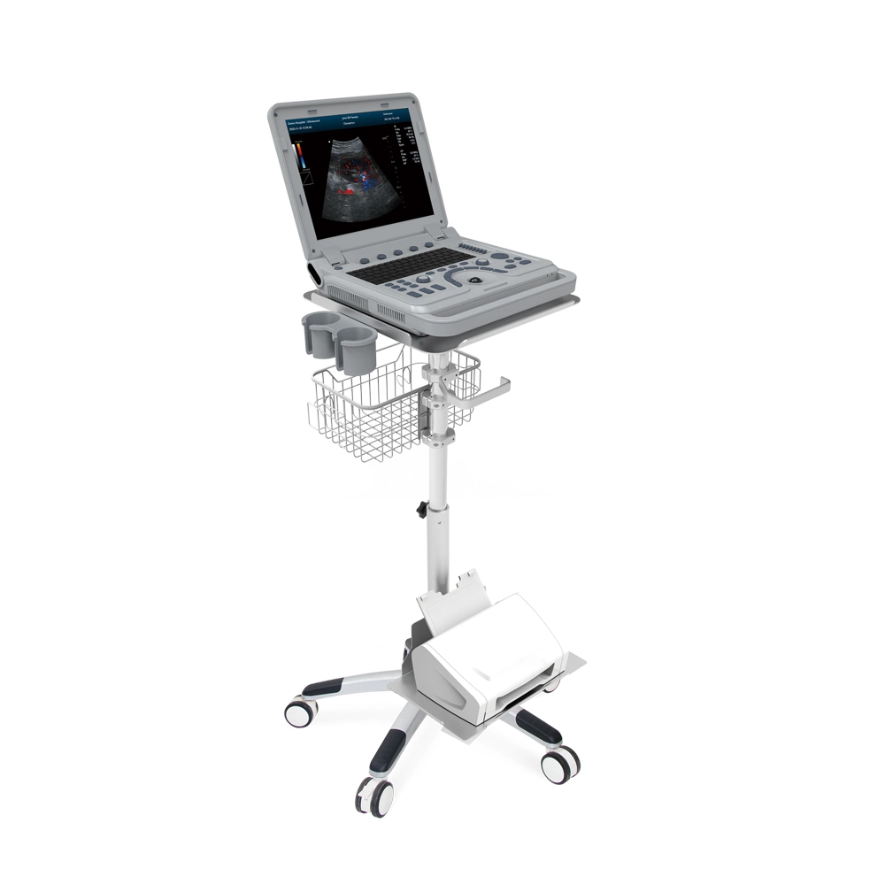 Contec Cms1700A Convex Array Extended Imaging Online Technical Support Ultrasound Machine