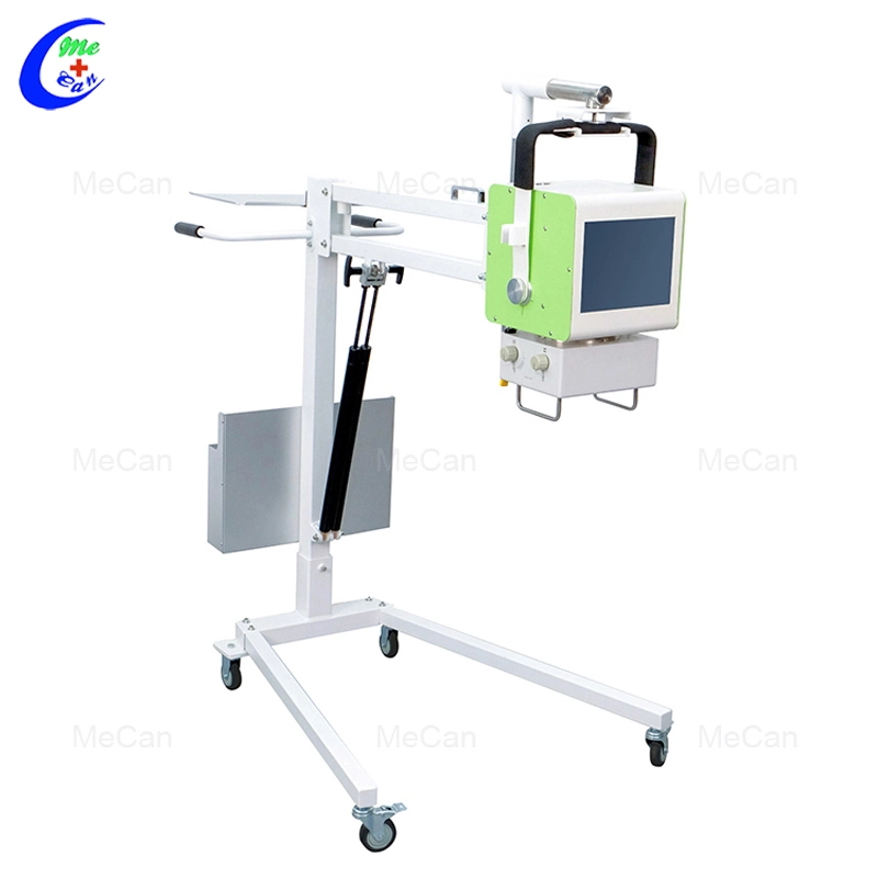 300 Ma 32kw Other Radiology Equipment Medical X Ray Portable X-ray Machine with Cheap Price