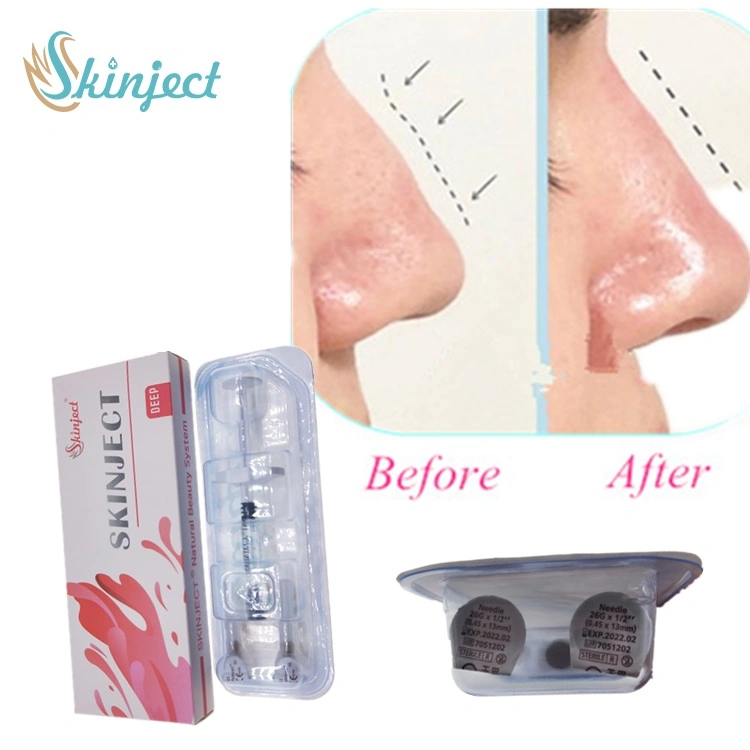 Skinject Hyaluronic Acid Dermal Filler for Cosmetic Surgery Deep 2.0ml