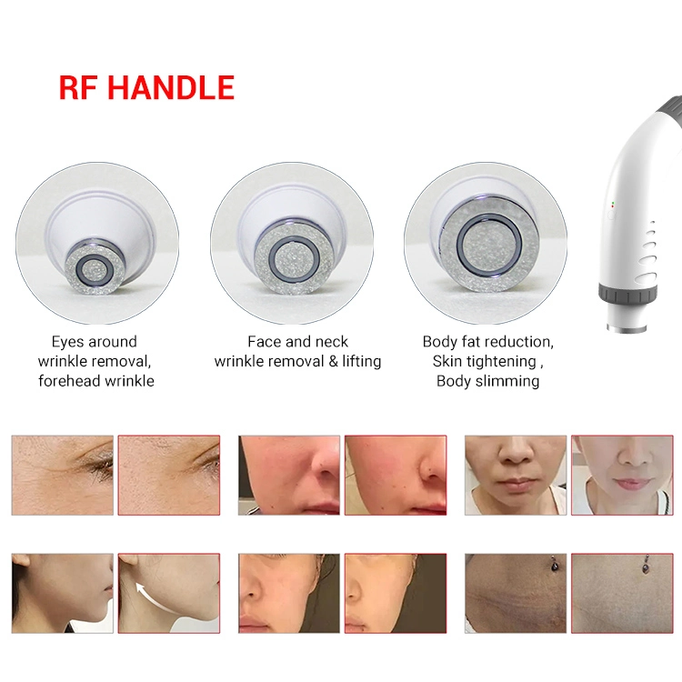 Multifunction 5 in 1 Q Switched ND YAG Laser Elight Opt IPL Hair Removal Machine