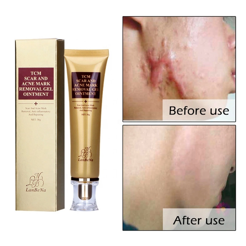 Centella Asiatica Scar Remove Cream Acne Mark Treatment Cream Spot Remove Gel