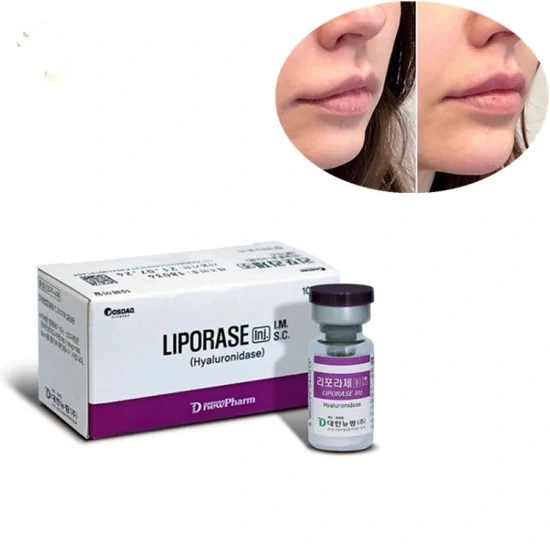 Dissolves Hyaluronic Acid Dermal Filler Liporase Hyaluronidase Powder Injection