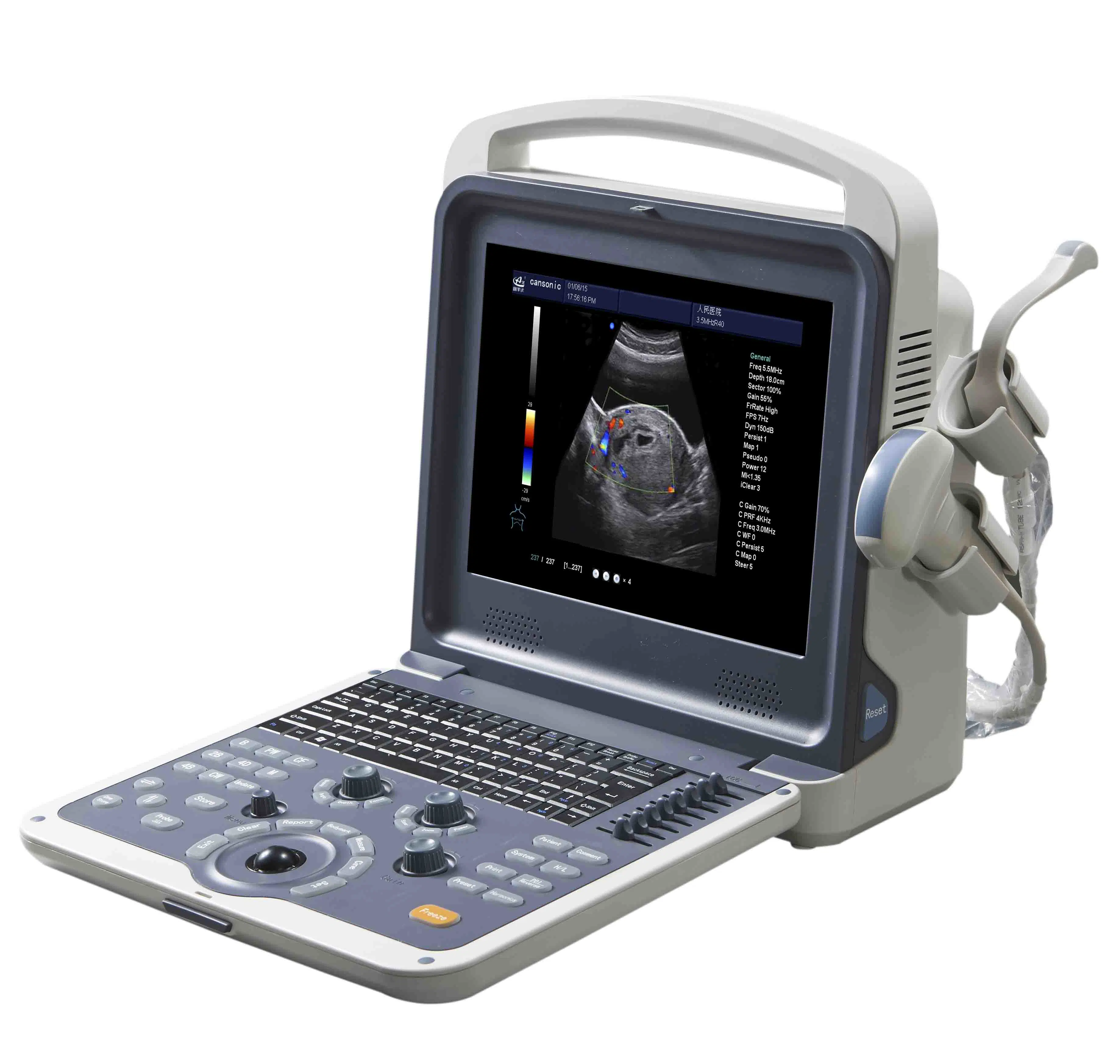 Advanced 4D Portable Full Digital Color Doppler Ultrasound Scanner (K2)