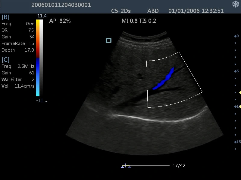 Am-5000 Full-Digital Color Doppler Ultrasound Diagnostic System Ultrasound Scanner