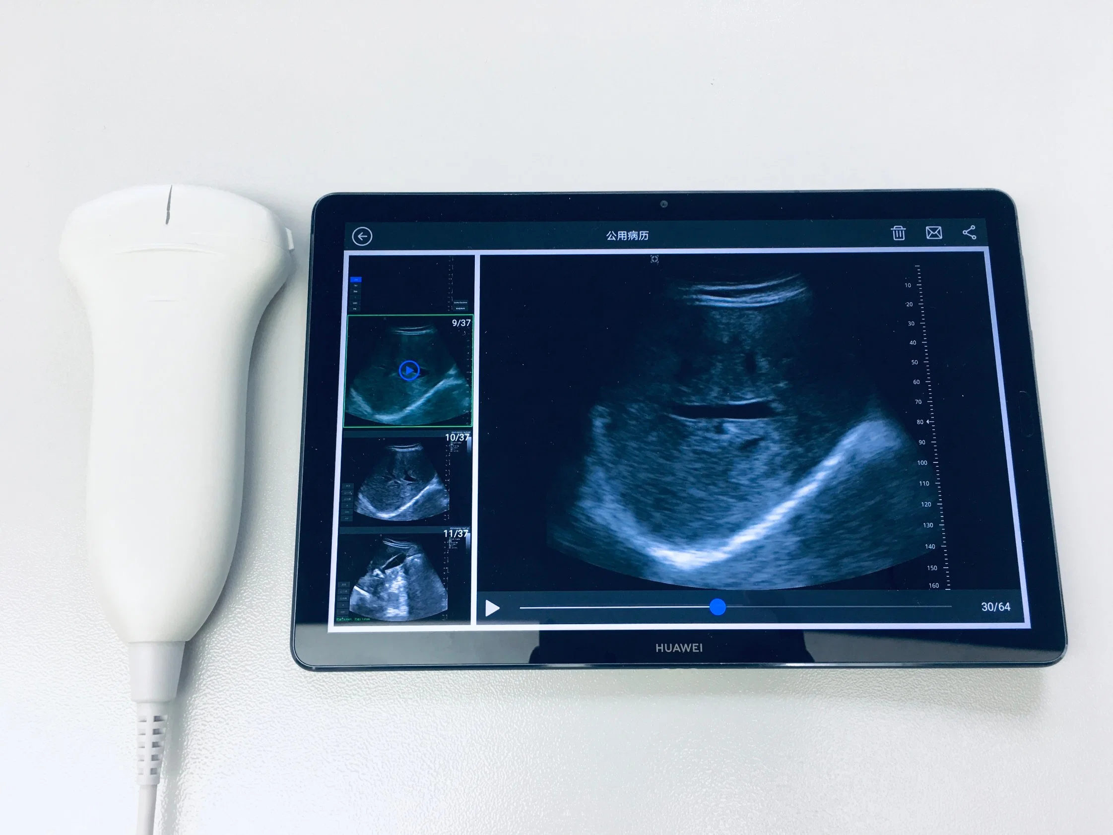 Línea de escáner de ecografía obstétrica del corazón fetal Doppler Color de bolsillo inalámbrico Máquina médica portátil de Doppler de ultrasonidos tres en uno