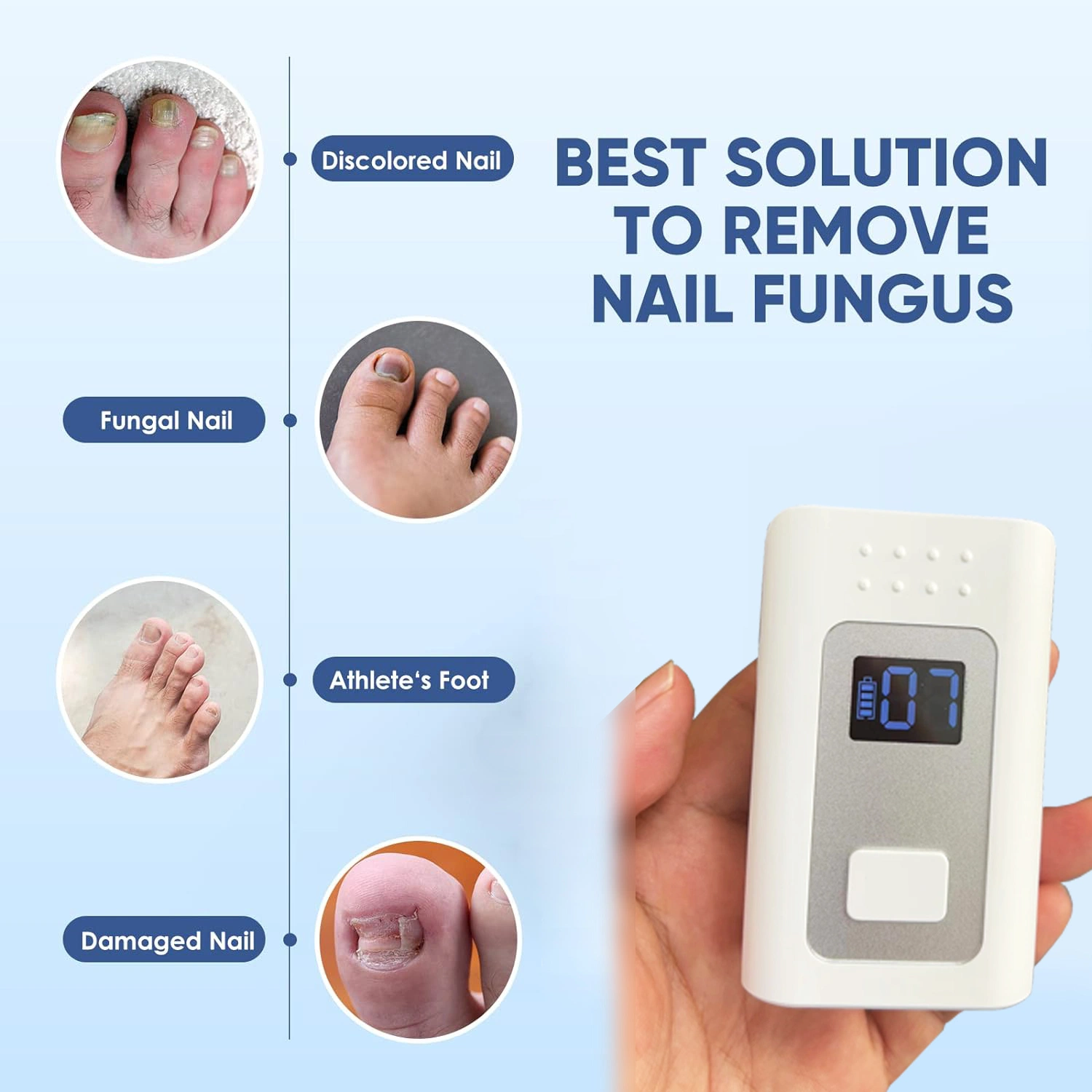 Портативный аккумулятор 905 нм 470 нм Blue Light Finger Nail Fungus Laser Терапевтическое устройство