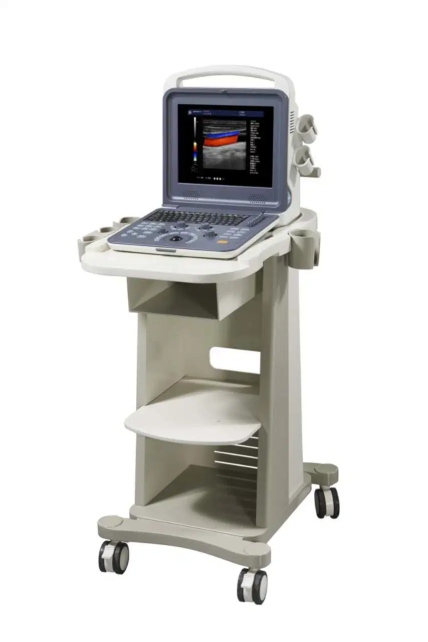 Sonoscape S30 Mejor Imagen 3D/4D Ultrasonido Doppler en Color con Carro