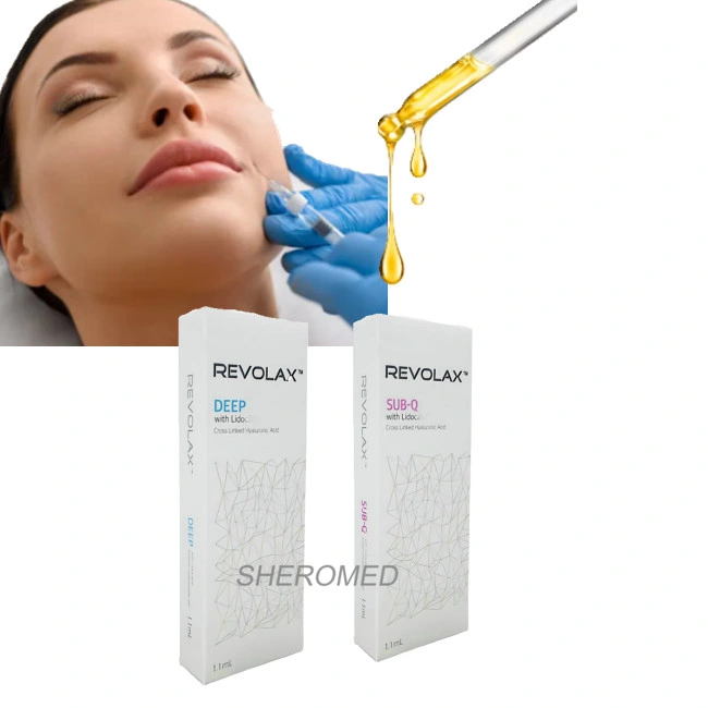 1mL Revolax verbessert die Gesichtsfalten Hyaluronic Gel für Nasolabiallinien