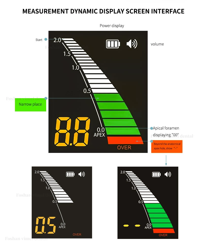 Sistema de localización de Apex de canal raíz de Endo pantalla LCD Equipo dental