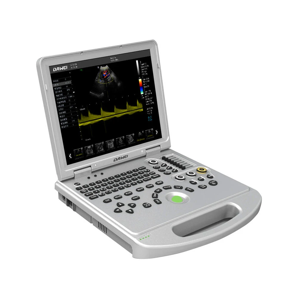 Portable Veterinary Color Doppler Ultrasonic System Veterinary Ultrasound