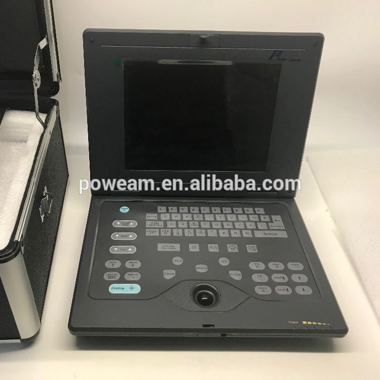 Laptop Veterinary Ultrasound Scanner (WHYB2018P)