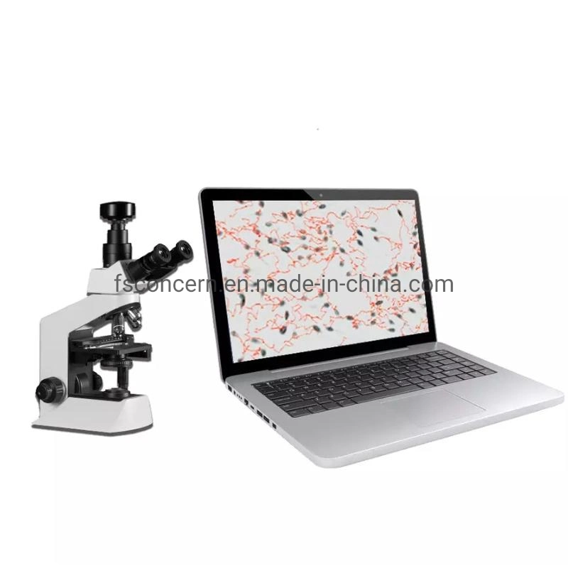 Krankenhaus Andrologie Tragbare Laptop Sperma Quality Analyzer Casa Sperma Analyse Gerät
