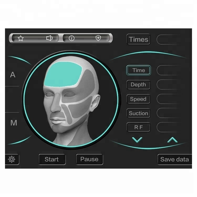 A frequência de rádio Microneedling melhor vendendo produtos 2018