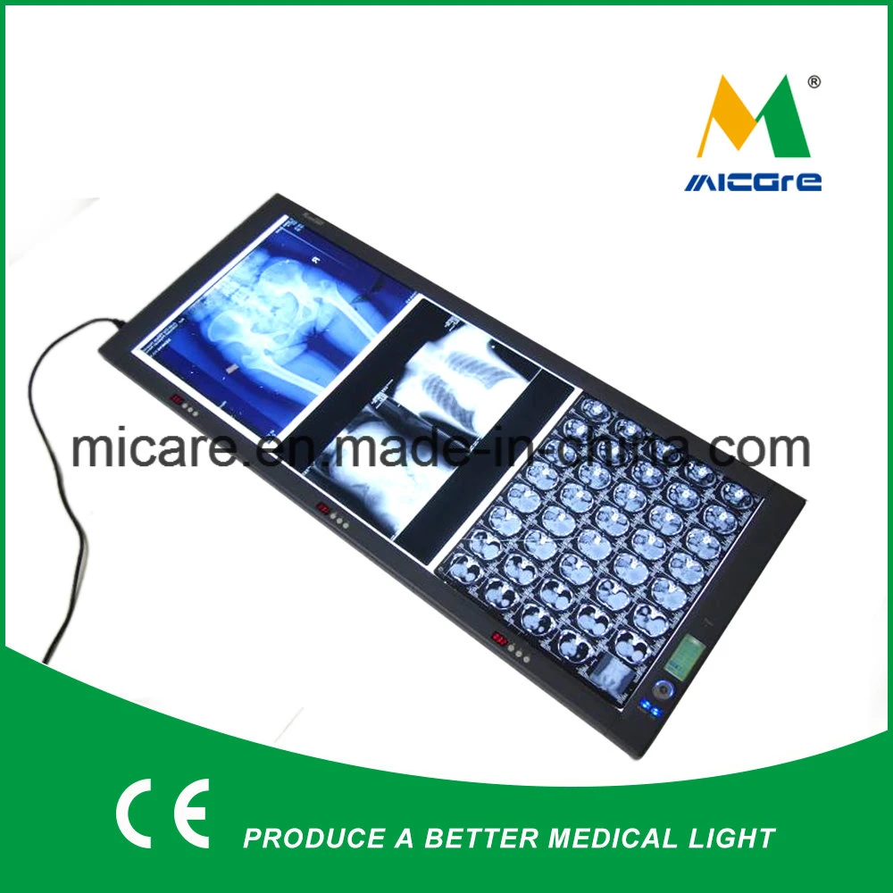 LED Viewing Box, X Ray Viewer, Negatoscope, Medical Film Viewer Double Screen Zg-3c