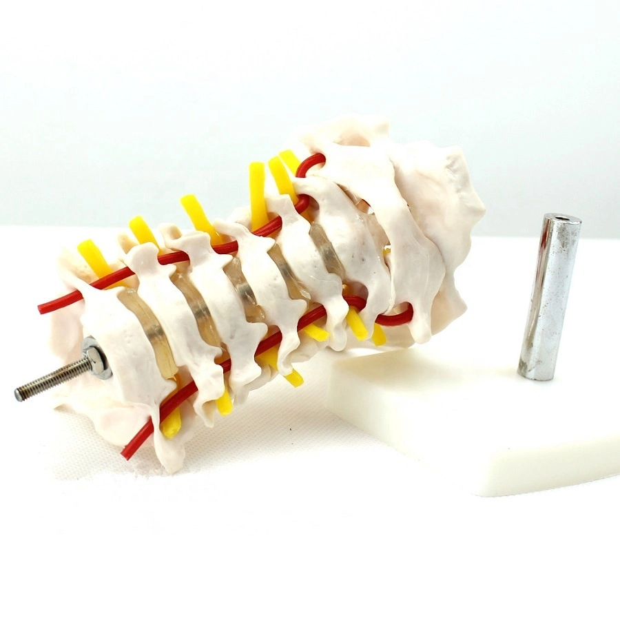 Consta de 3 Lumbar Vertebray 2 medialmente dividido Vertebra2parts