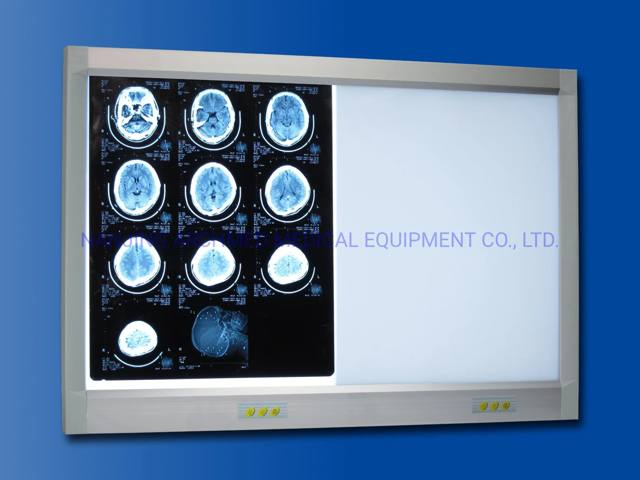 L'équipement médical 2.5cm Super-Thin LED X-ray avec double panneau film illuminateur