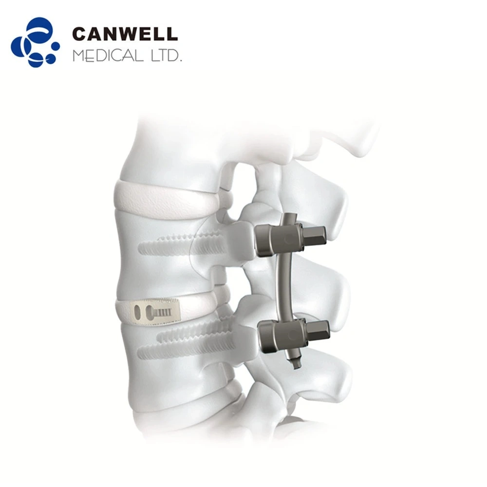 Canwell Medical Spine Titan polyaxiale Pedicle Schrauben für die Wirbelsäulenfixierung Orthopädische Chirurgie Implantate Instrumente Set