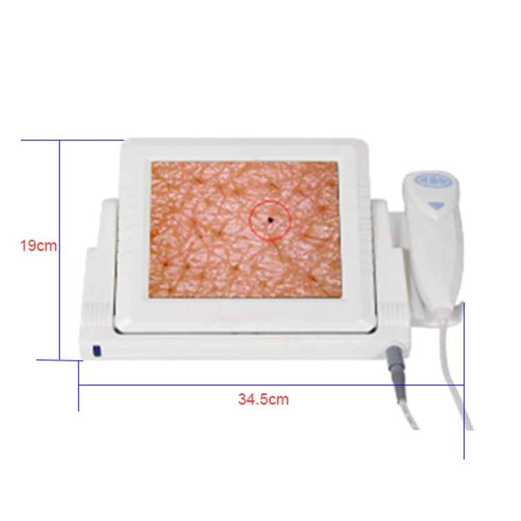 Allfond Skin Analyzer Skin Test Machine mit 8 Zoll Bildschirm