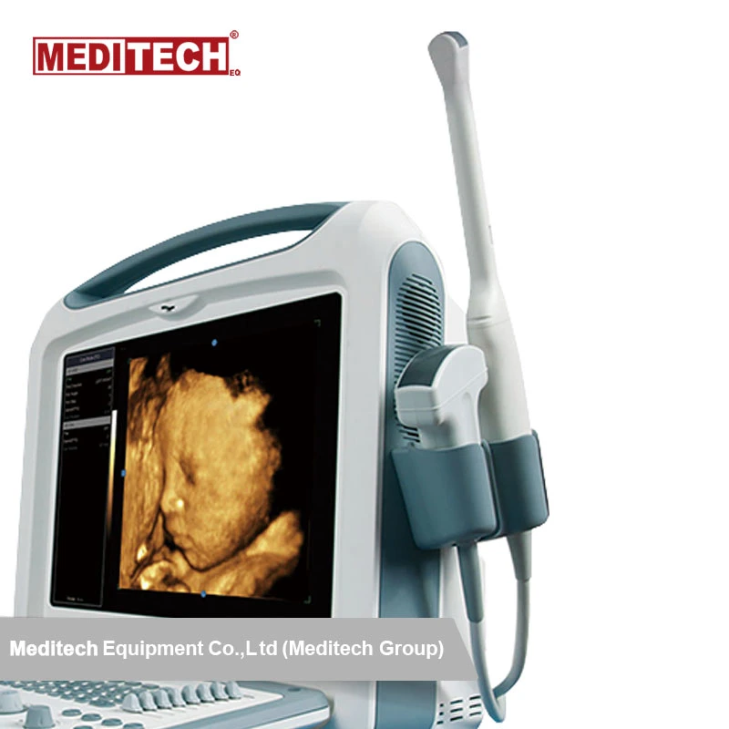 Portable Color Ultrasound Scanner Medical Device Doppler Ultrasound Equipment