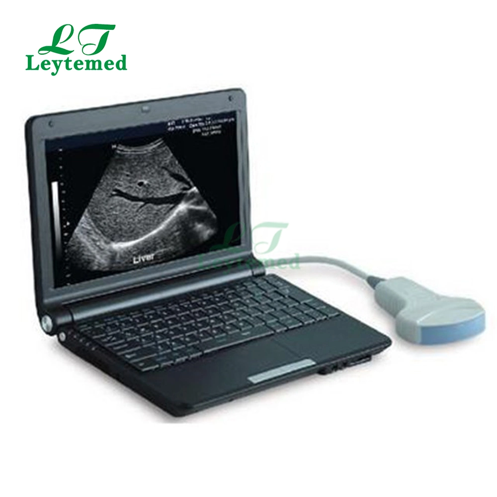 Ltub25 Laptop Portable Full Digital Medical Pregnancy Scanner Ultrasound Echography Equipment