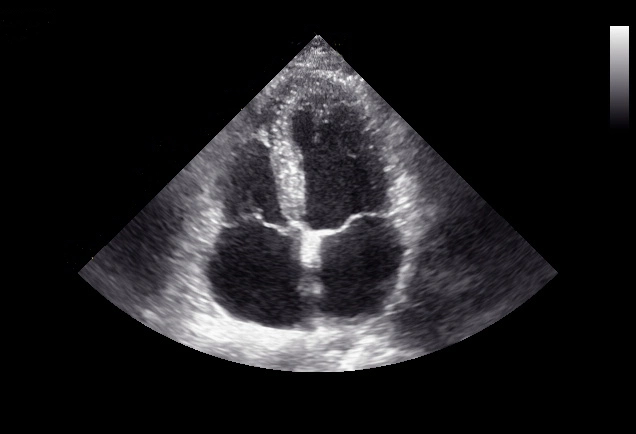 4D Trolley Color Doppler Ultrasound (K10)