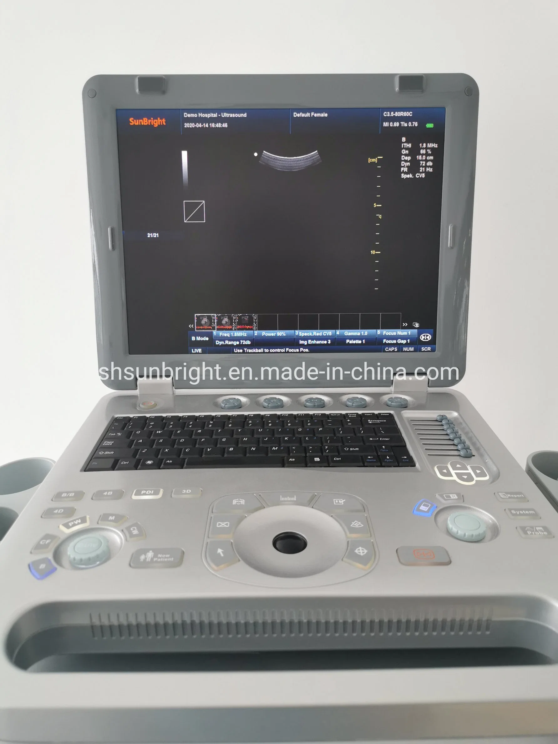 Scanner de ultra-sons de EFP portátil veterinário totalmente digital 4D Color