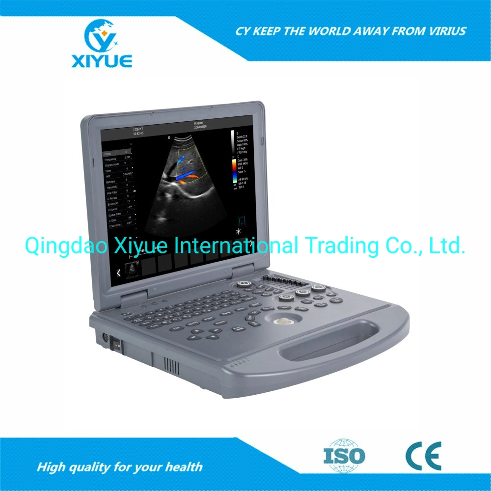 Full Digital Color Doppler Ultrasound Diagnosis System/ Laptop Portable Handheld Ultrasound