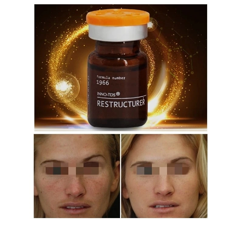 Célèbre Inno-TDS Restructurer la glutathion antioxydant blanchissant la peau dépose les taches de rousseur Rajeunissement de la peau d'injection antivieillissement taches blanchissant retirer de la mélanine