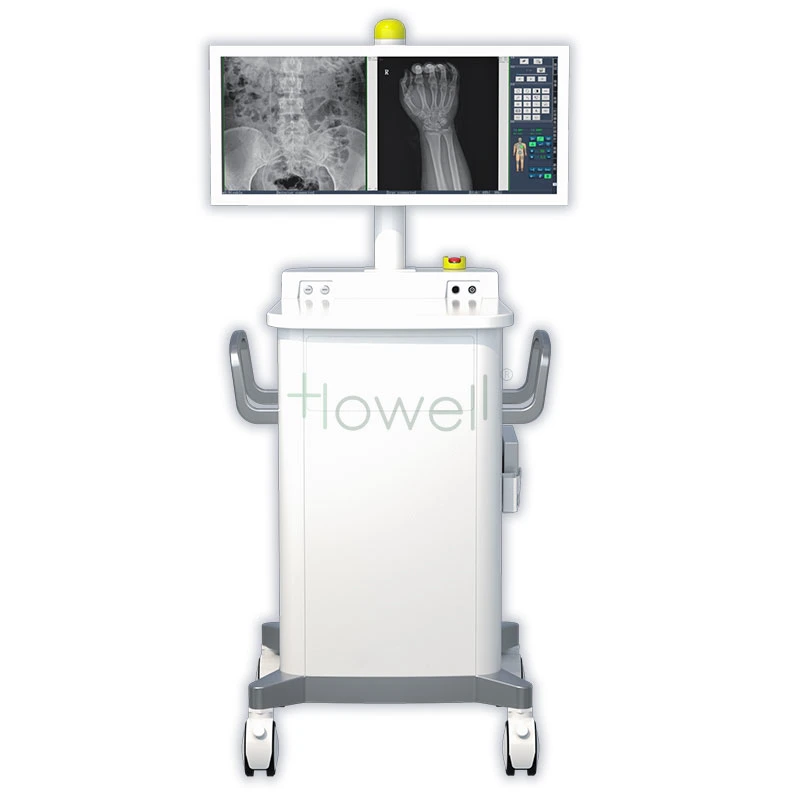 Mobile Digital C-Arm System Digital Radiography System Equipment Raidography X-ray Imaging System