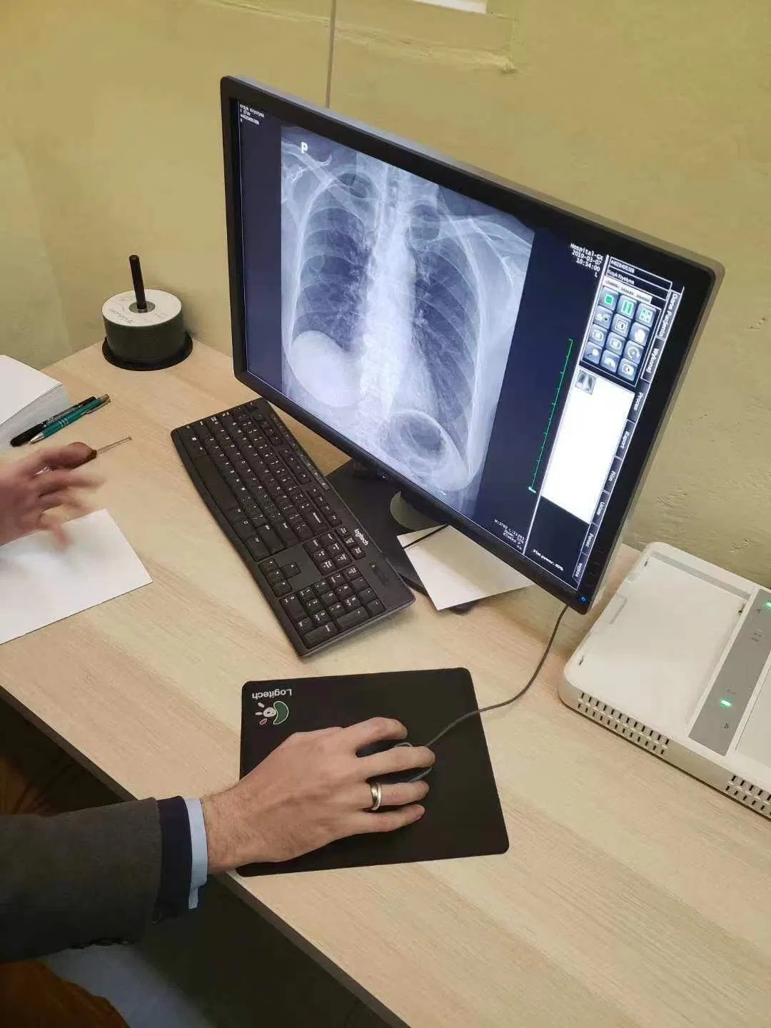 Doble sistema de radiografía de columna