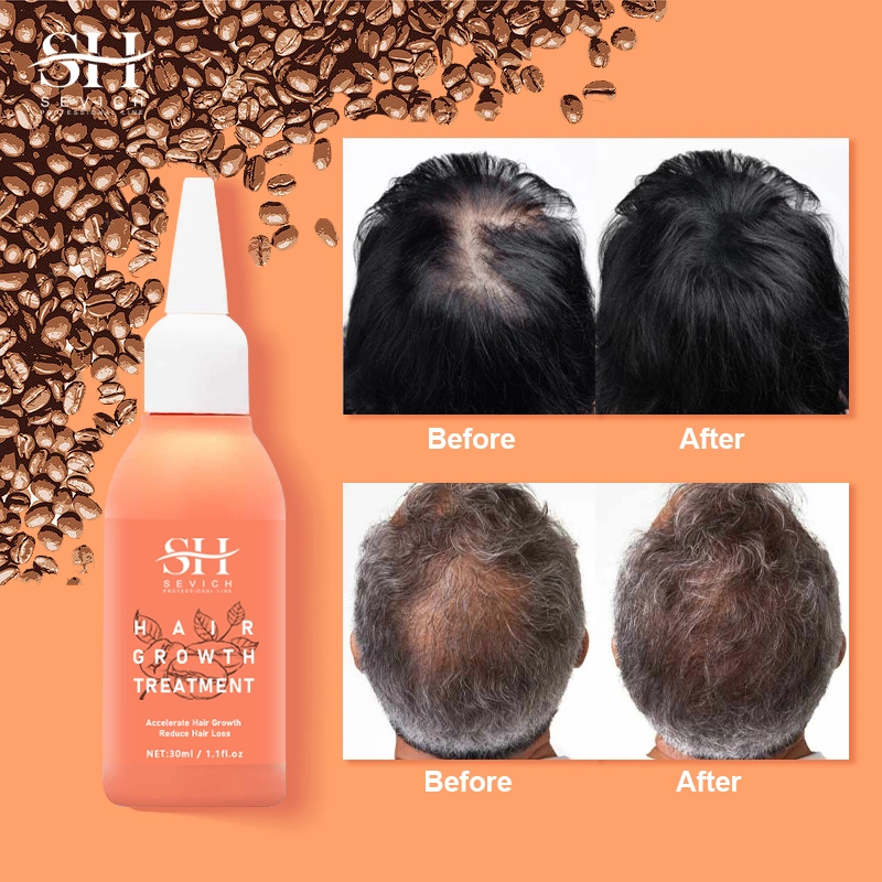 Hair Growth Treatment Products Strengthening Repair Hair Growing Serum Oil