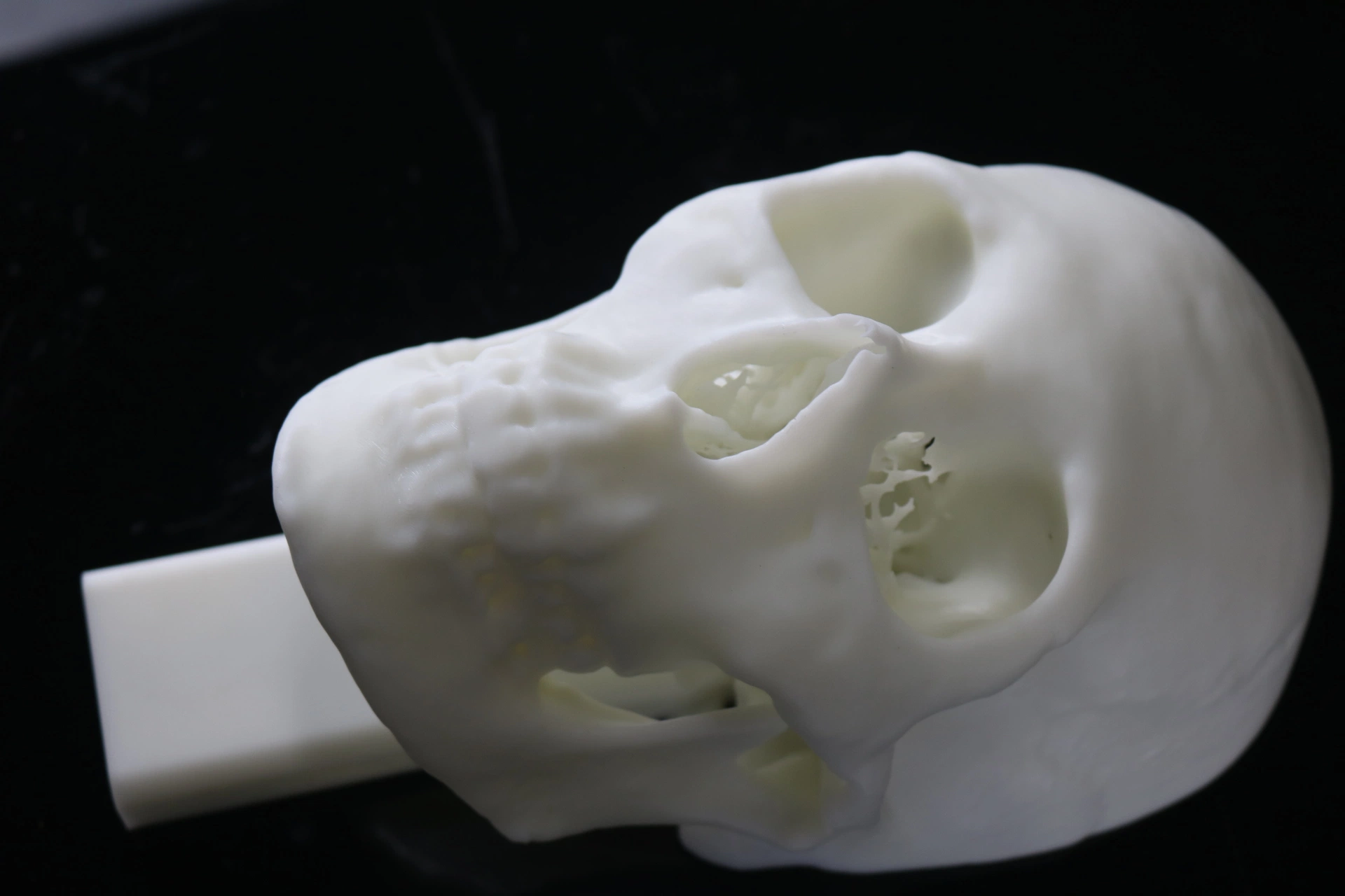 3D impresión SLA material resina cráneo Planificación preoperatoria, médica