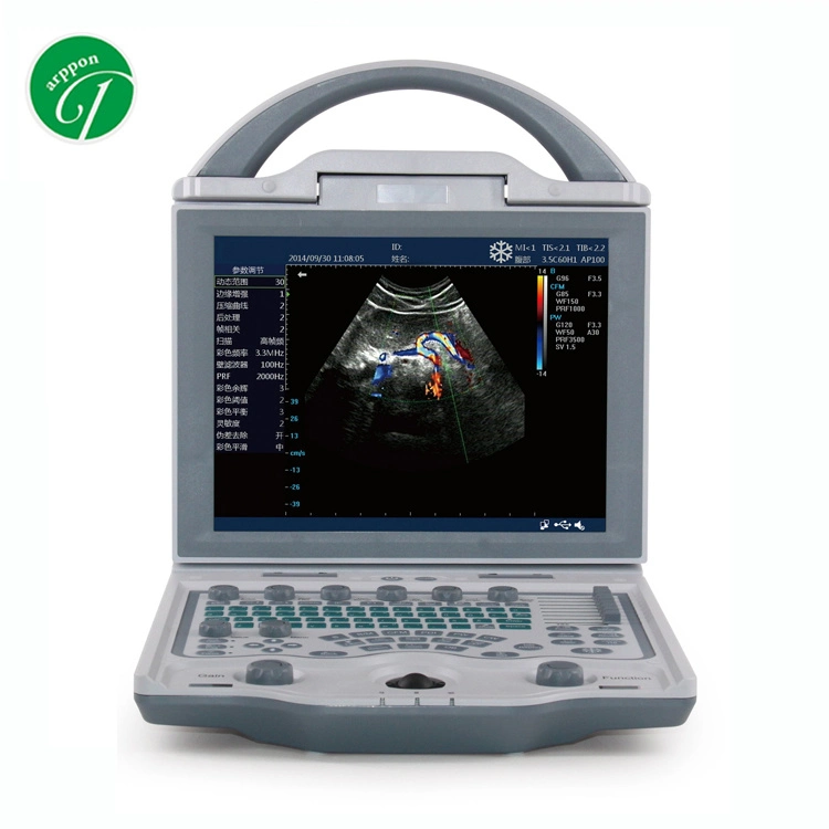 Veterinary Portable Laptop Pregnancy Ultrasound Equipment 4D Color Doppler Veterinary Ultrasound System Machine