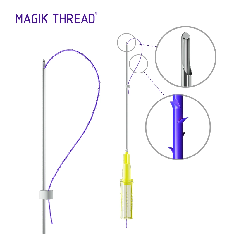 Pdo Thread Lifting Fios De Pdo Needle Hilos Tensores 3D 4D Cog Nasolabial Folds Lift