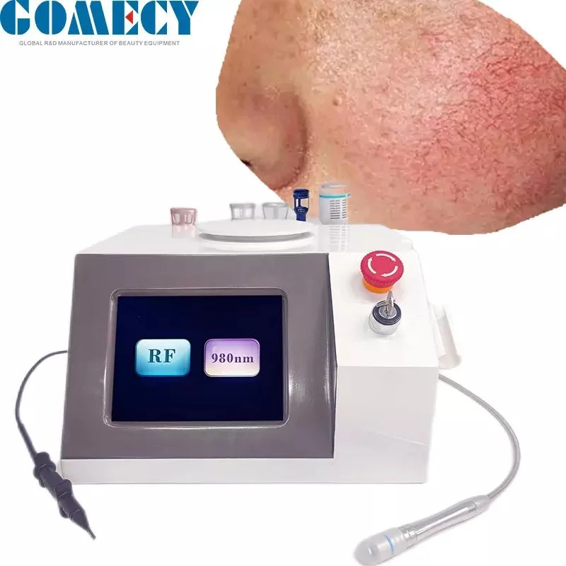 2022 Hot Sale 980nm Laser infection fongique des ongles Machine de traitement