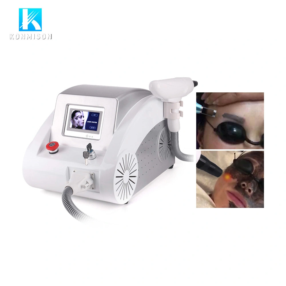 Best China Factory Price ND YAG Laser Q Switch Laser Tattoo Removal Machine