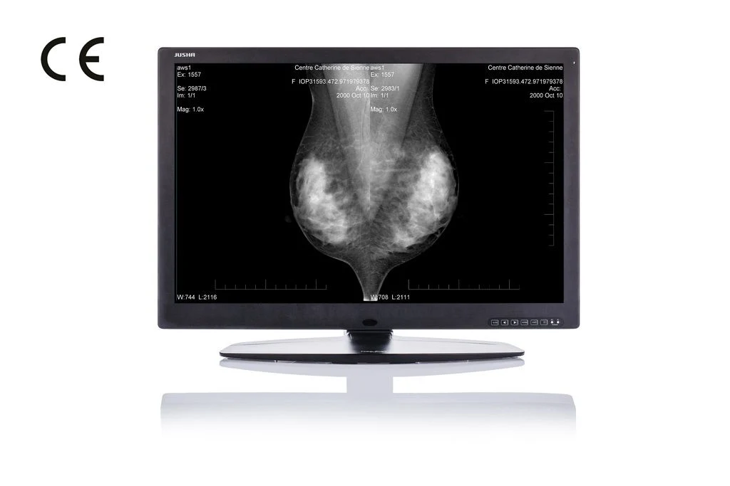 30inch 10MP High Resolution Display System for X-ray Medical Device, CE