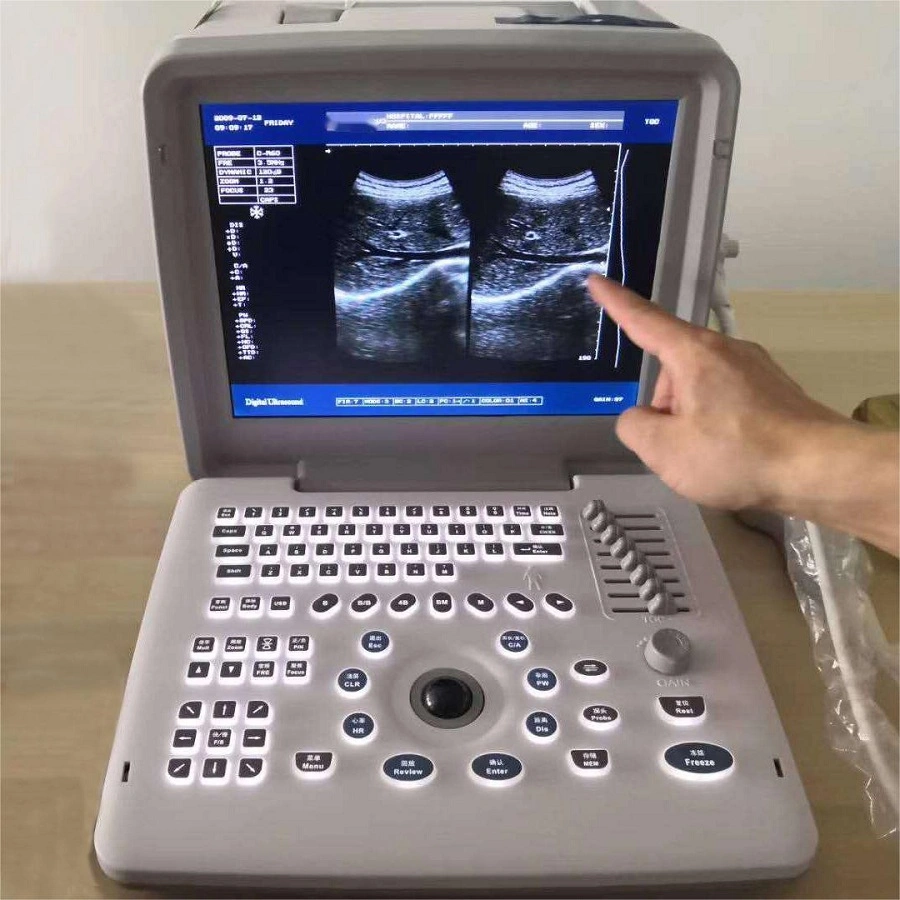 Echocardiography Machine Examination Scanner Echography Laptop Black and White Digital Instruments Ultrasound