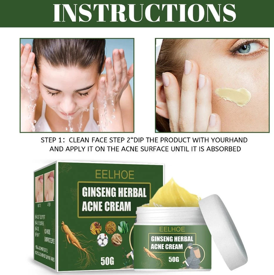 Costom Effective Acne Removal Cream Herbal Acne Spots Oil Control Acne Cream Skin Care Whitening Moisturizing Face Gel Skin Care Acne Removal Cream