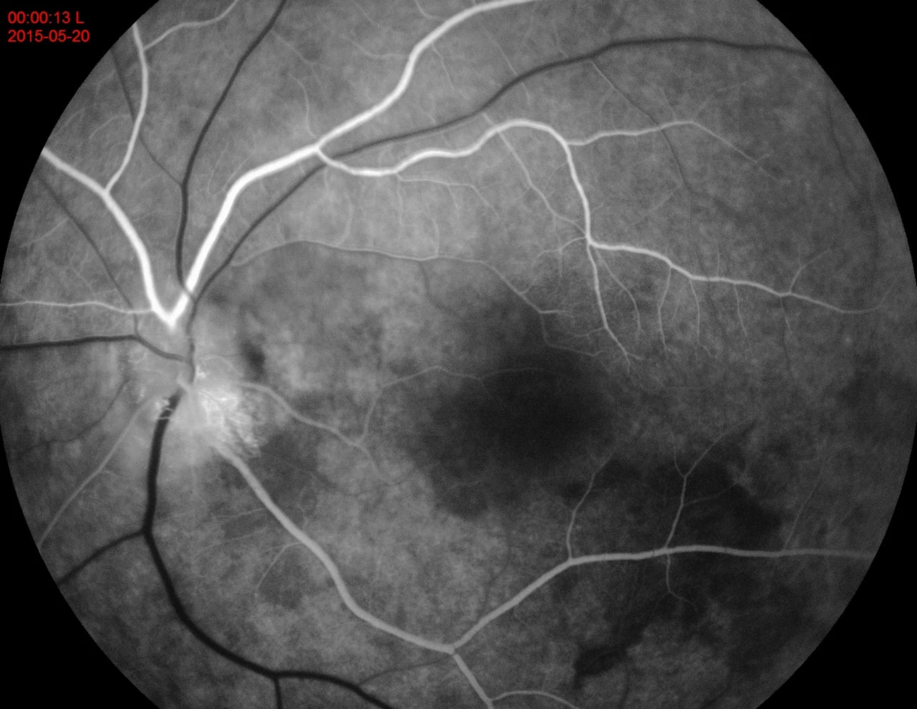 Medical Ophthalmology Fundus Camera Ffa Model Auto Focus Function PT-Aps-Ber, Model B