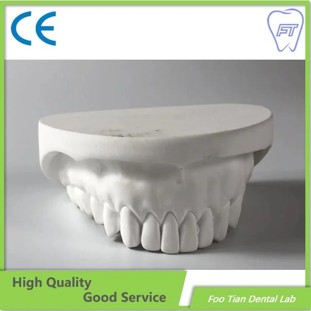 بيع denture Cast Partial Framework Dental مخصص