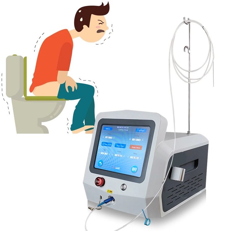 El mejor tratamiento con láser de diodo láser médico Cirugía de hemorroides con 980 Nm 1470 Nm Proctología