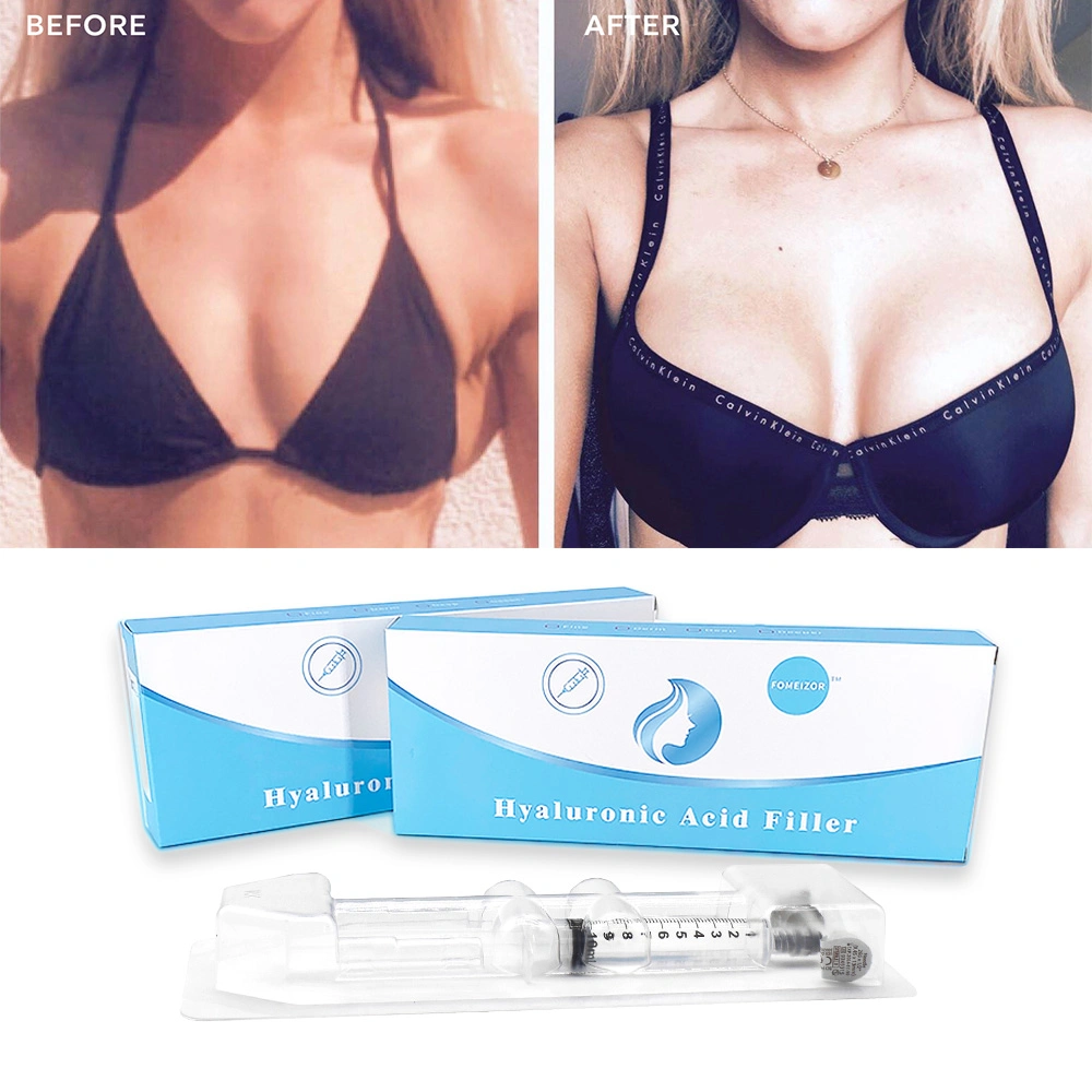 No Side Effect Breast Enhancement Enlargement Cross-Linked Injectable Hyaluronic Acid Dermal Filler