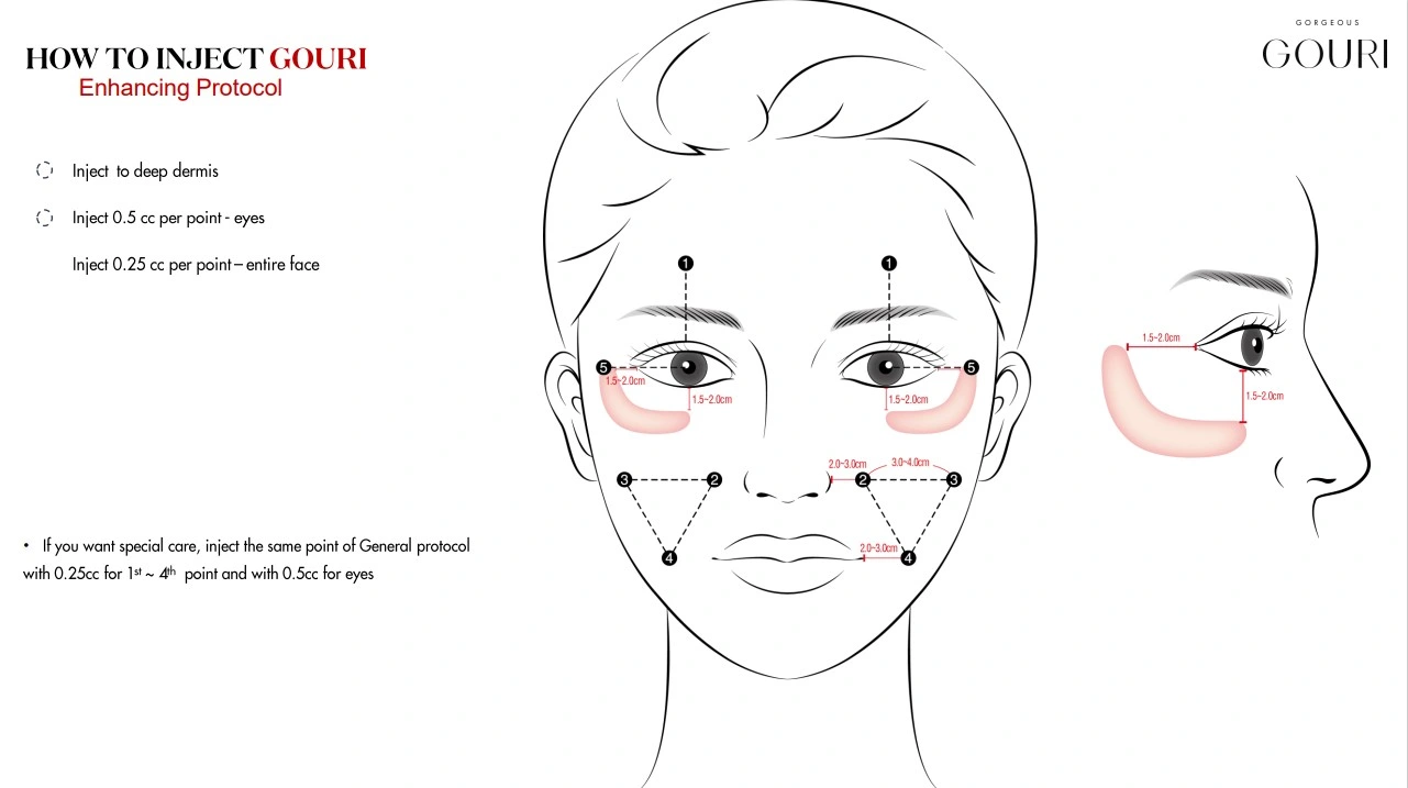 2023 pele do estimulador de colágeno Gouri original Polycaprolactone injetável PCL dérmico Enchimento de enchimento Gouri face de injeção volume rugas Remove Olidia Plla