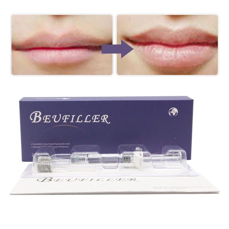 China Best Hot Selling 2ml Deep Derm Face Filler Lip Injection Hyaluronic Acid Dermal Filler