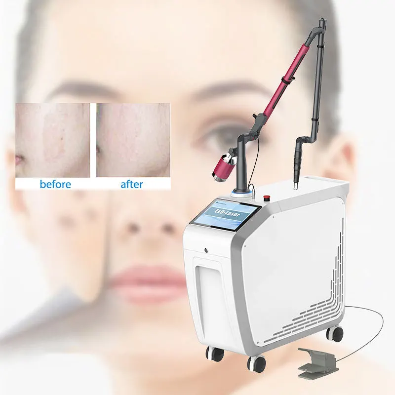 Hot Selling ND YAG Laser Tattoo Removal Skin Center