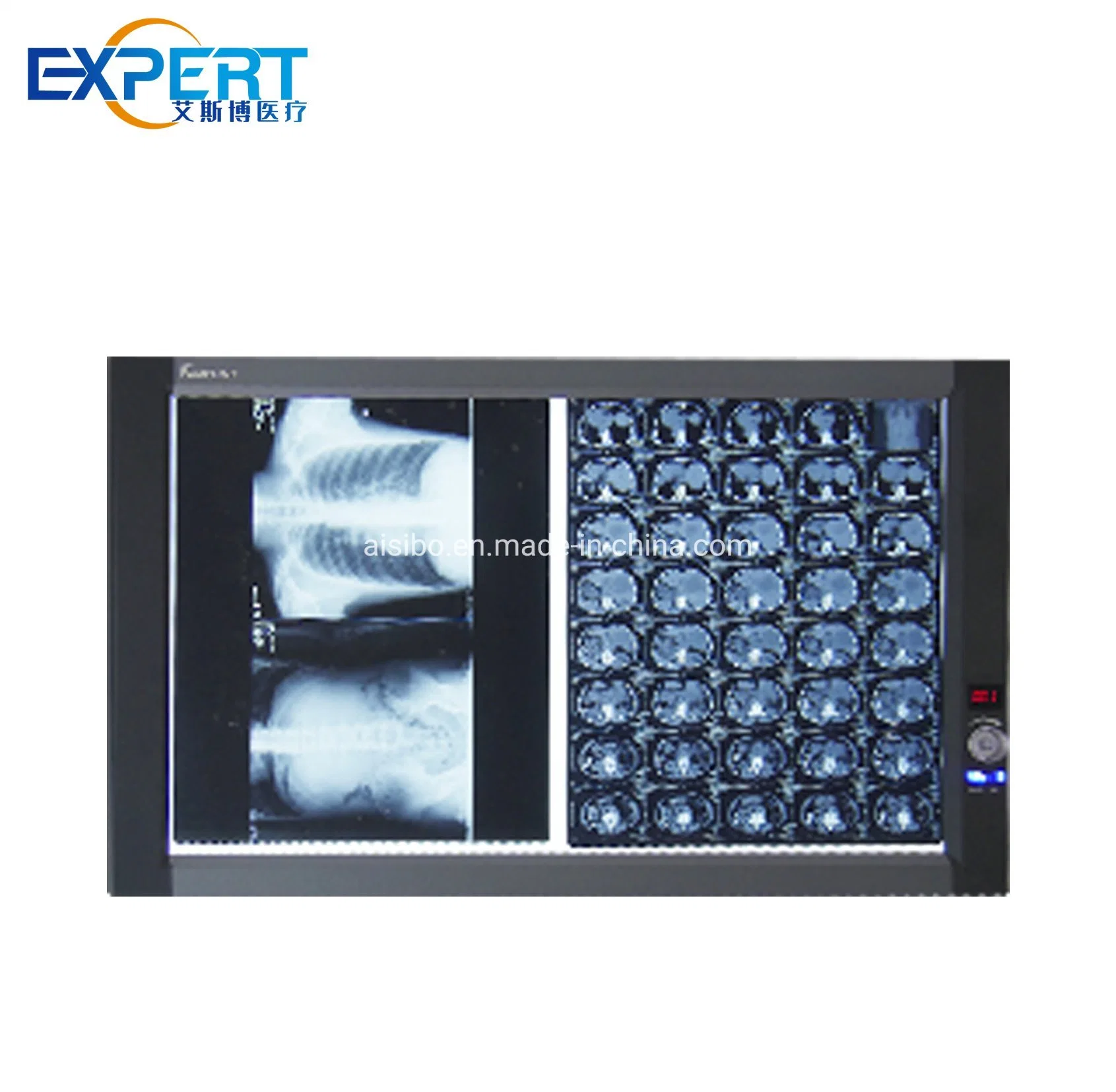 Hospital Equipment LED Ultra-Thin LCD Film Viewer X-ray