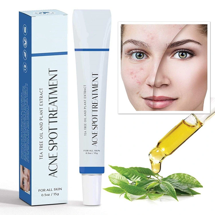 Premium Natural Formula Acne Spot Treatment for Acne Prone Skin Care