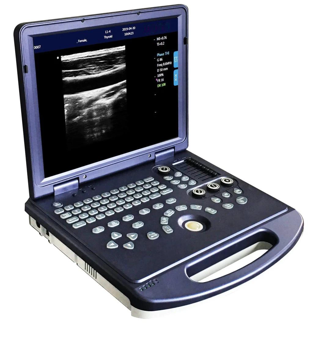 Wholesale/Supplier Price Medical Diagnosis Equipment Machine High quality/High cost performance Full Digital Pw Function Black and White B&W Portable Laptop Diagnostic Ultrasound Scanner